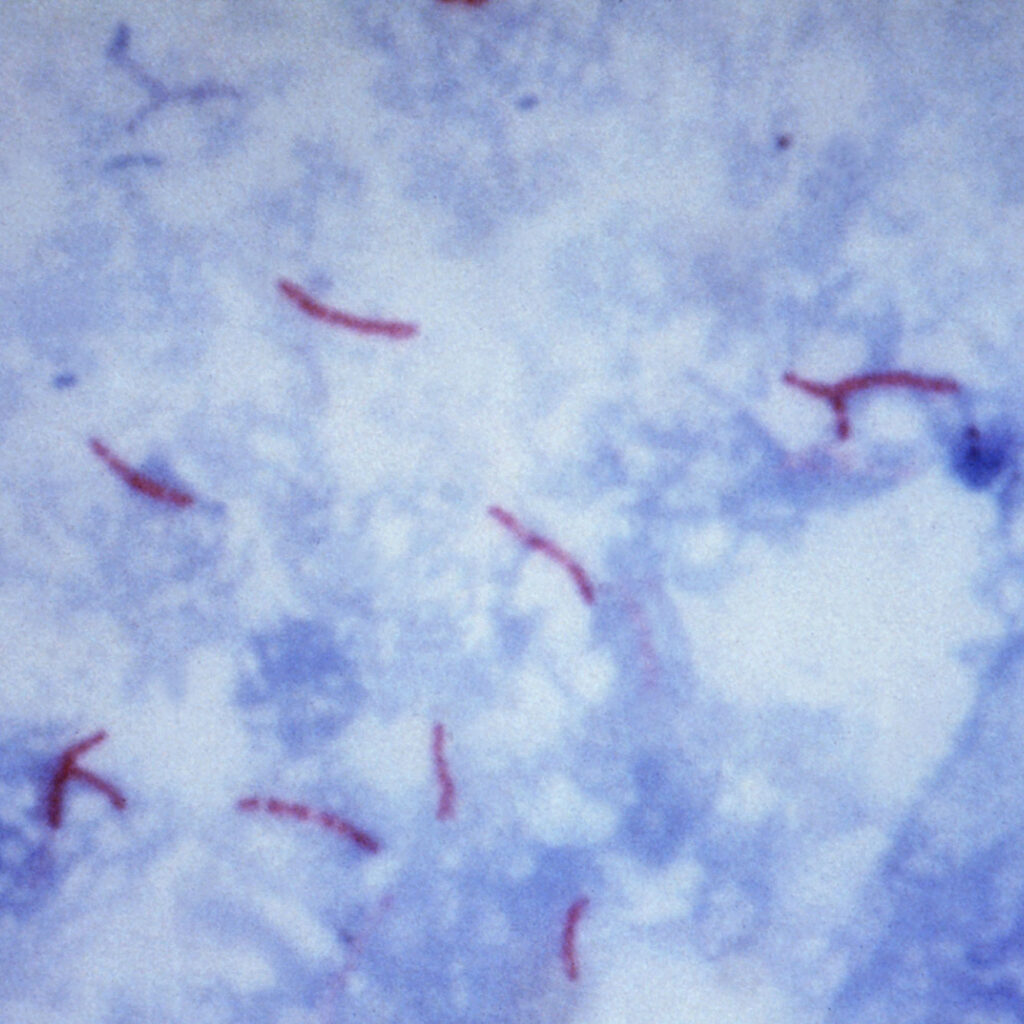 Mycobacterium tuberculosis
