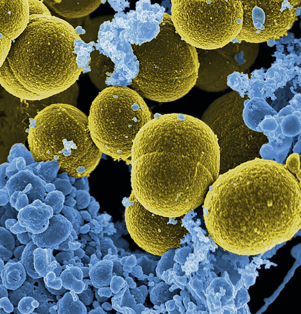 Staphylococcus